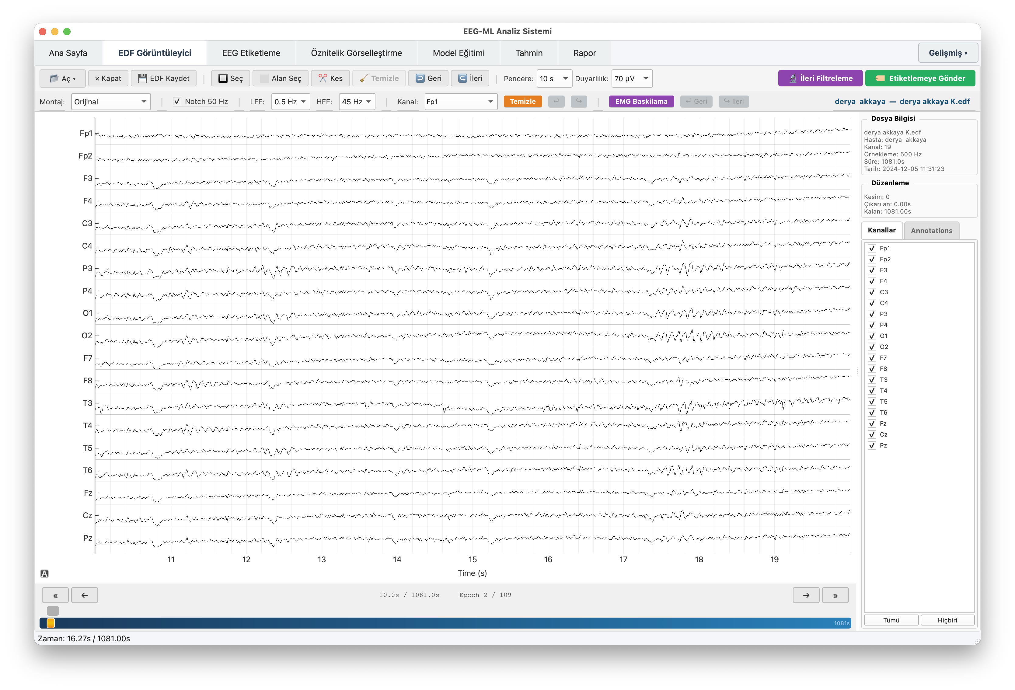 EEGVision EDF görüntüleyici - çok kanallı EEG sinyal görüntüleme ve montaj seçimi