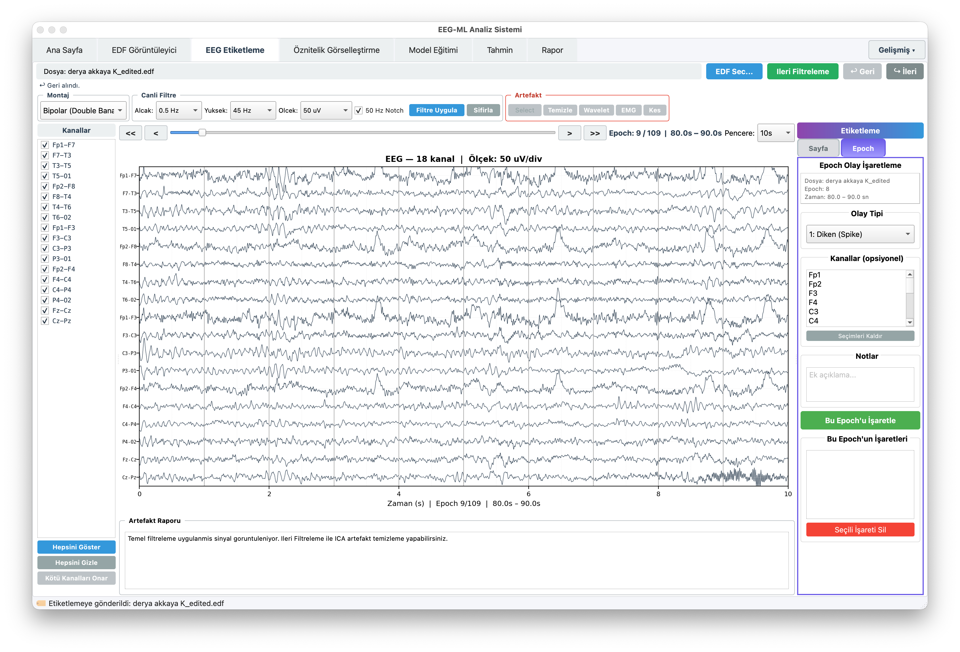 EEGVision EEG etiketleme - epoch işaretleme ve epileptiform aktivite sınıflandırma