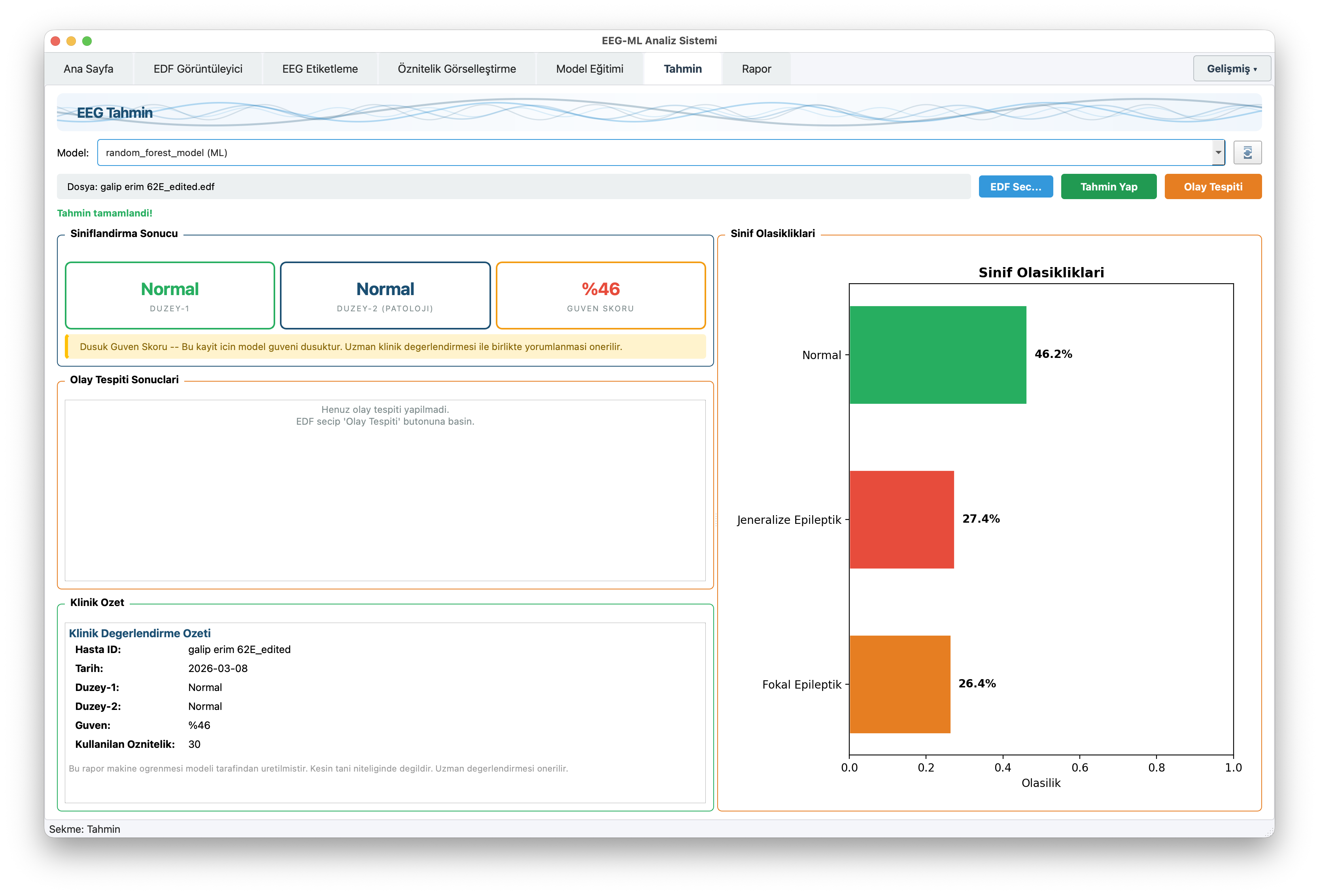 EEGVision tahmin - EEG sınıflandırma sonuçları ve olasılık dağılımı
