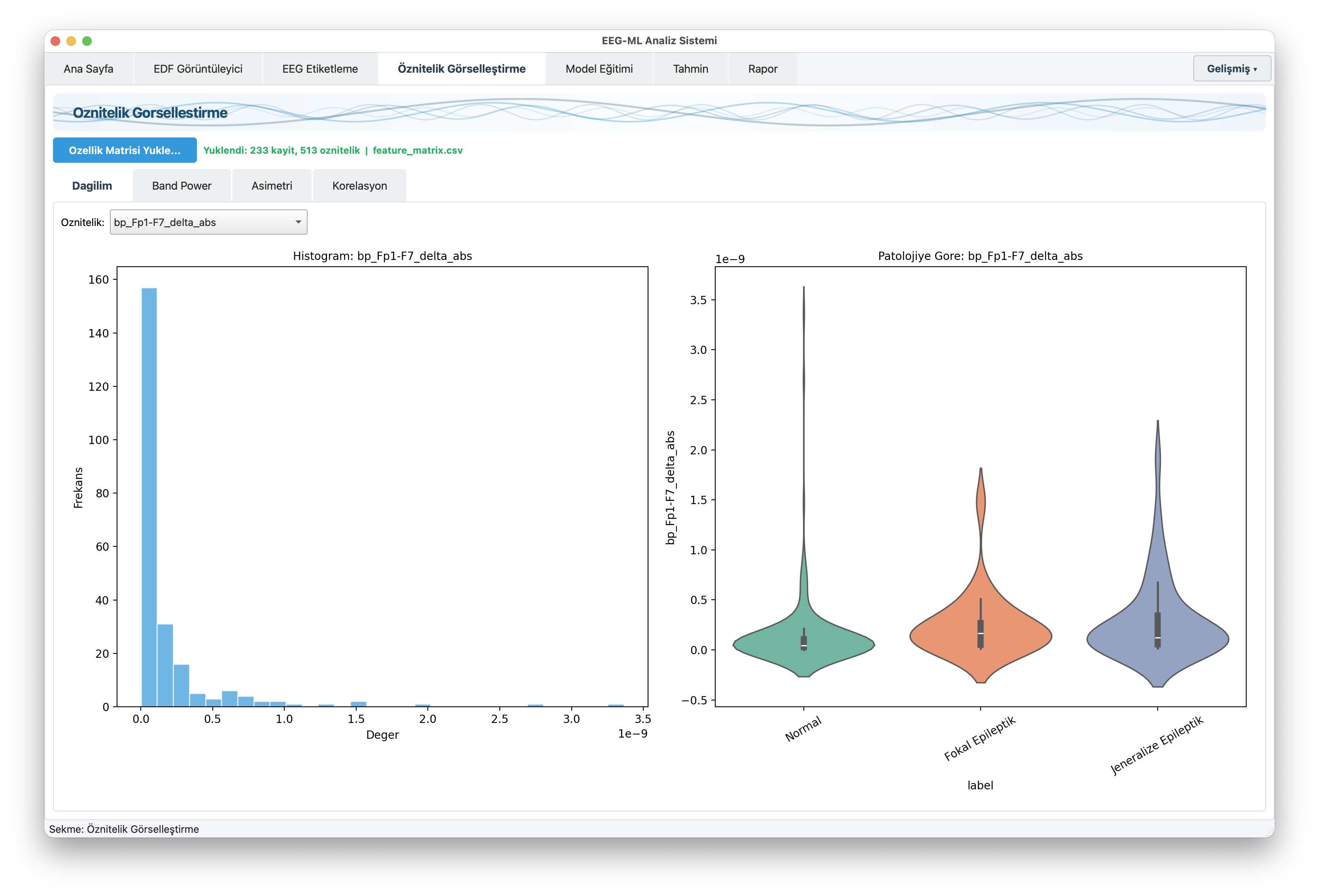 EEGVision klinik rapor - otomatik EEG analiz raporu ve dağılım grafikleri