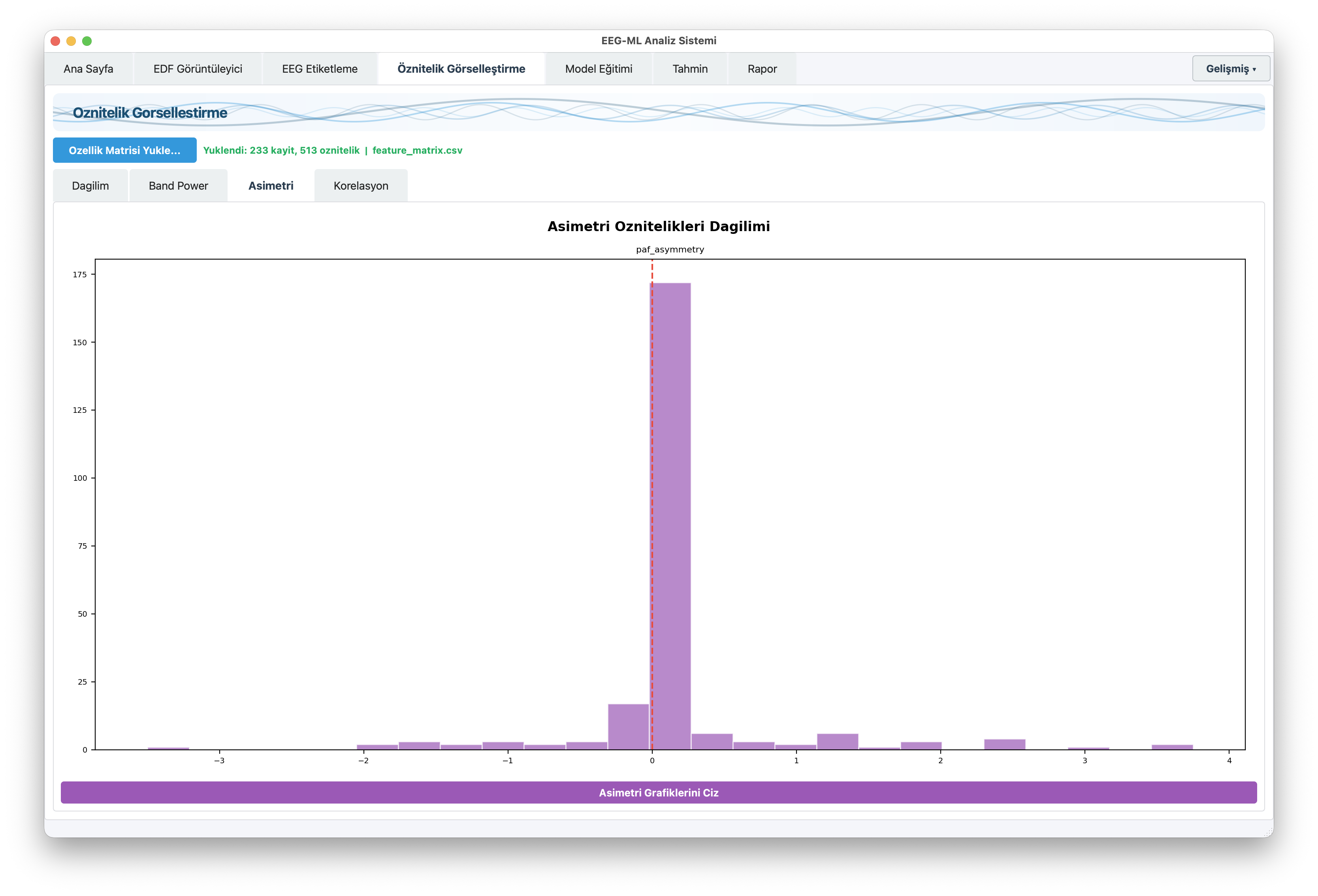 EEGVision öznitelik görselleştirme - EEG asimetri analizi ve band power dağılımı