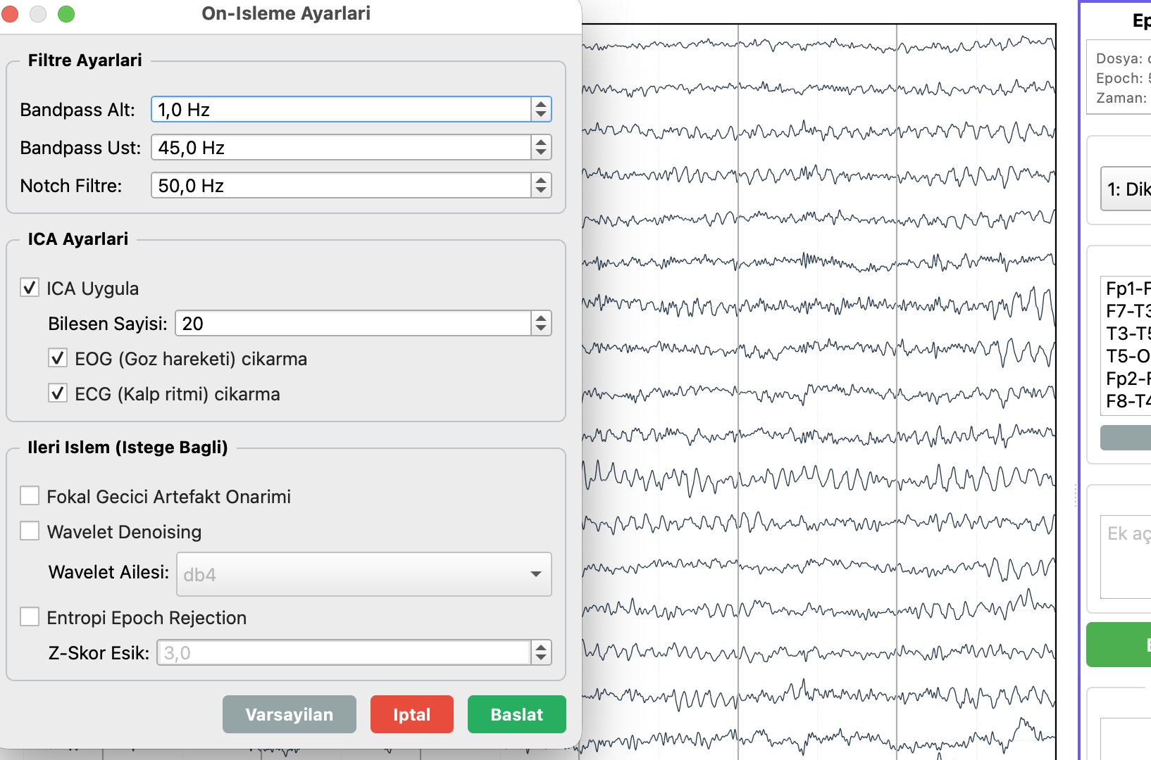 EEGVision ön işleme - bandpass filtreleme, notch filtre ve ICA artefakt temizleme